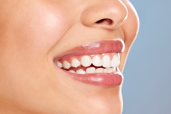 How Does Teeth Whitening Work?