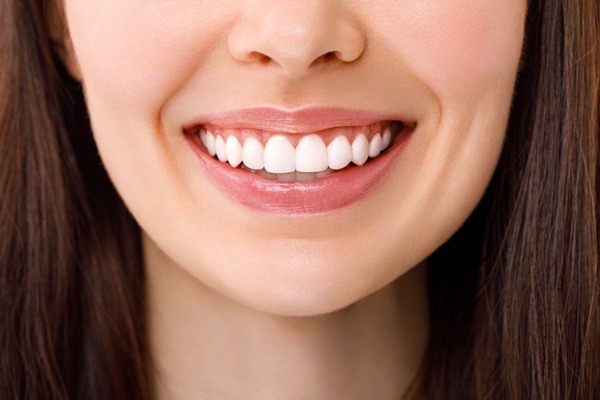 When Is An In Office Teeth Whitening Treament Recommended?